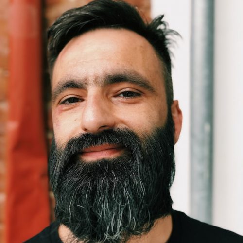 Transplante de Pelos Faciais